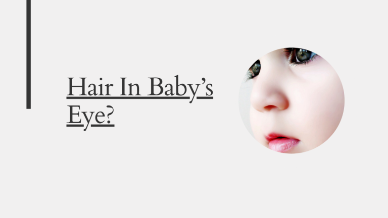 Hair In Baby’s Eye? The 2 Best Ways to Get Hair Out