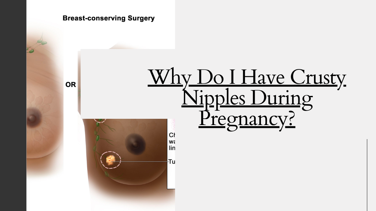 Why Do I Have Crusty Nipples During Pregnancy